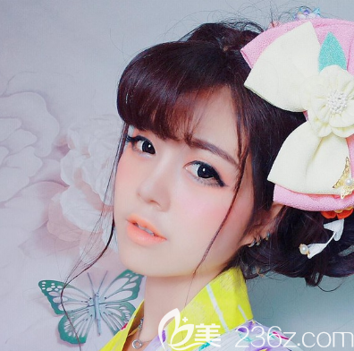 去东莞华美找詹慧院长做鼻综合隆鼻的时候才知道之前在美容院打的是假玻尿酸