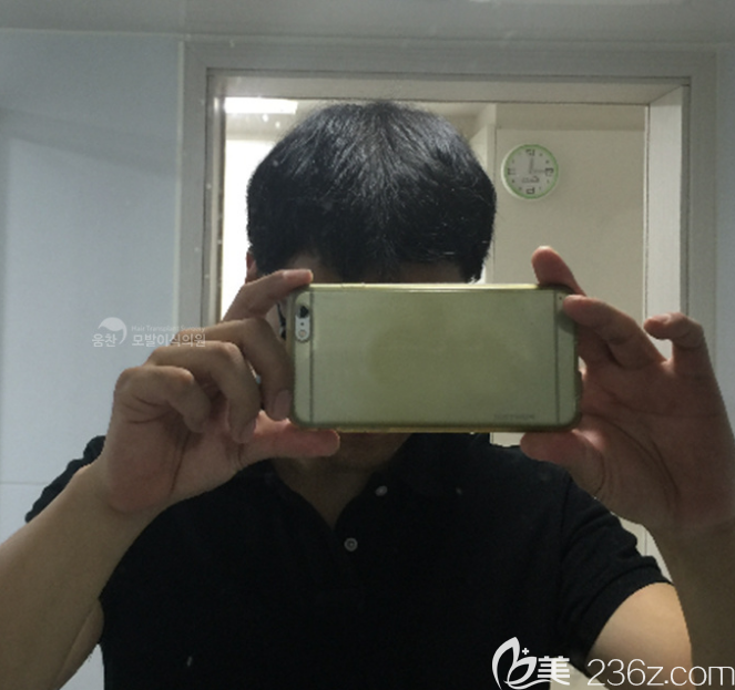 韩国永长玄尚润做毛发移植怎么样