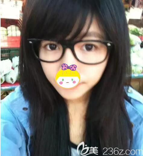 面诊无锡坤如玛丽想要注射丰卧蚕 面诊无锡坤如玛丽想要注射丰卧蚕