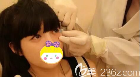 无锡坤如玛丽医生注射丰卧蚕过程中 无锡坤如玛丽医生注射丰卧蚕过程中