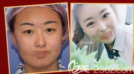 <!--<i data=20240703-sp></i>-->院长眼综合案例对比