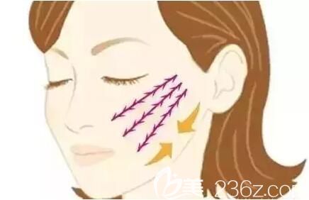 面部线雕之后会导致面部变得僵硬吗? 面部线雕之后会导致面部变得僵硬吗?