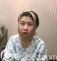 术后第1天 术后第1天