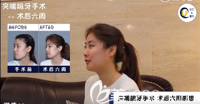 首尔UC牙科牙齿矫正怎么样 首尔UC牙科牙齿矫正怎么样