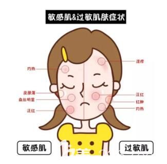 敏感肌与过敏肌的区别