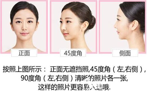 韩国灰姑娘(新帝瑞娜)免费整形模特照片标准 韩国灰姑娘(新帝瑞娜)免费整形模特照片标准