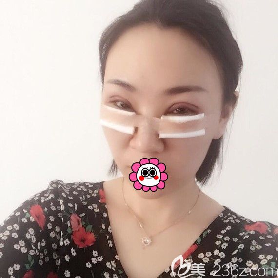 黑龙江瑞丽术后即刻