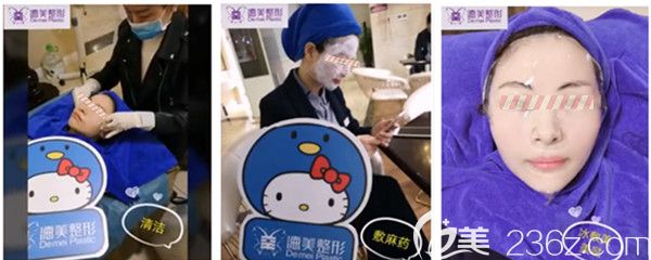 DNA童颜针注射过程图 DNA童颜针注射过程图