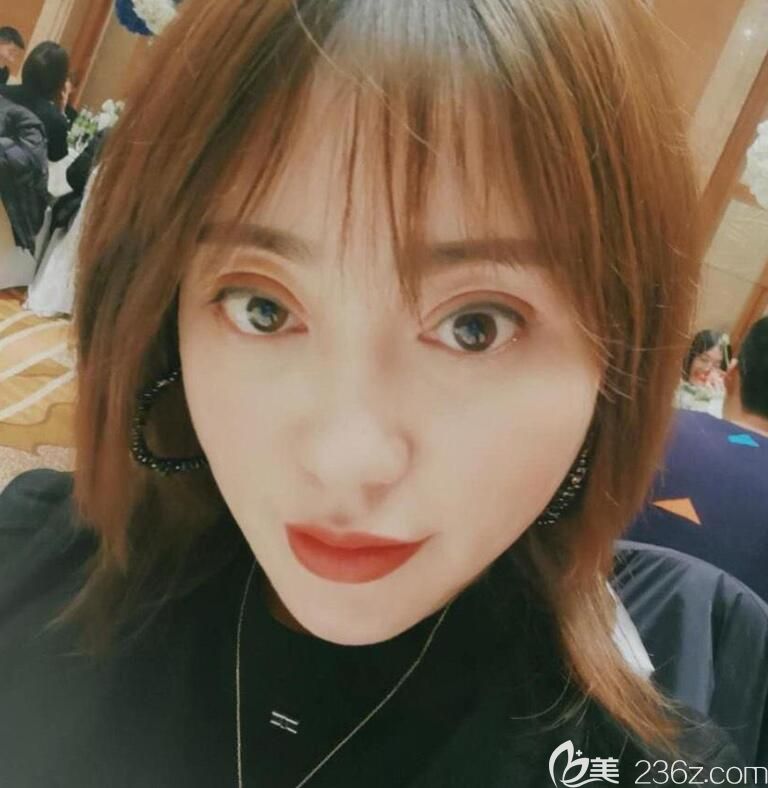 合肥白领安琪儿全脸线雕+玻尿酸填充泪沟+眼综合7天 图