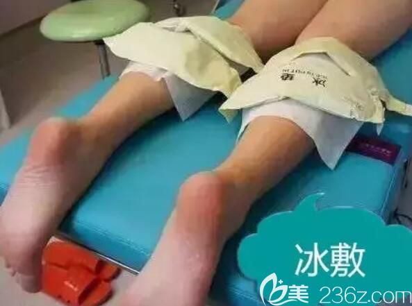 瘦脸除皱瘦腿术后需要冰敷 瘦脸除皱瘦腿术后需要冰敷