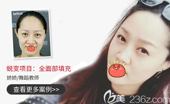 嘉兴曙光自体脂肪填充<span style= 嘉兴曙光自体脂肪填充<span style=