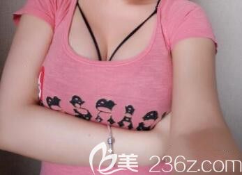 我在北海韩美做假体隆胸术后第15天
