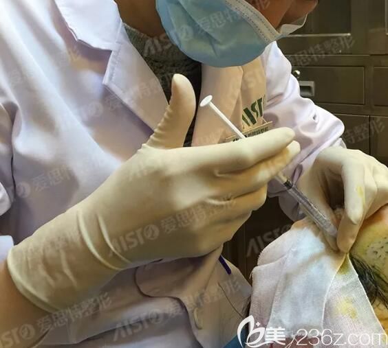 局部消毒后保证线雕的效果 局部消毒后保证线雕的效果