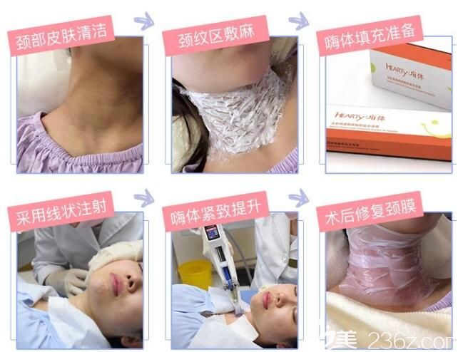 南京美贝尔分享嗨体去颈纹流程