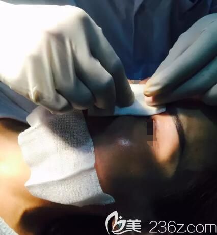 鼻子注射玻尿酸后还需要捏造塑形