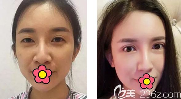 兰州时光相伴张晓萍修复眼睛怎么样 兰州时光相伴张晓萍修复眼睛怎么样