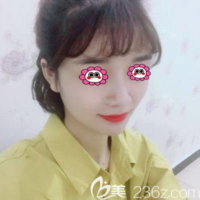 做完全脸填充第15天照片