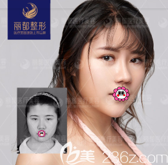 北京米兰柏羽丽都曹卫华眼修复案例 北京米兰柏羽丽都曹卫华眼修复案例