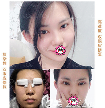 <!--<i data=20240703-sp></li>
<li><i data=20240703-sp></i>-->眼修复案例 <!--<i data=20240703-sp></i>--><!--<i data=20240703-sp></i>-->眼修复案例