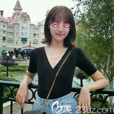 假体隆胸前的照片 假体隆胸前的照片