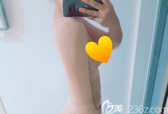 维摩整形外科吸脂怎么样 维摩整形外科吸脂怎么样