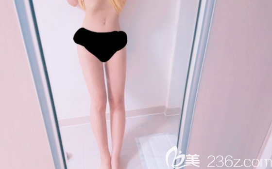 吸脂后一个月 吸脂后一个月