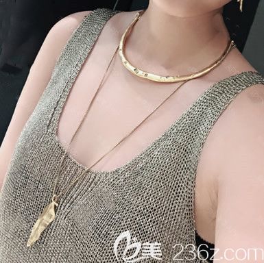 呼和浩特张高贵医疗美容门诊部张高贵术前照片1