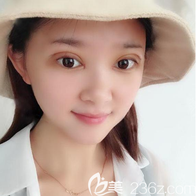 佛山医博士门诊做双眼皮怎么样