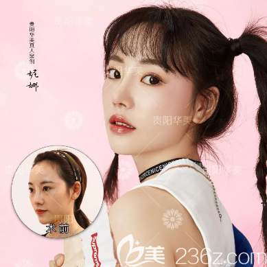 贵阳华美做鼻修复怎么样？