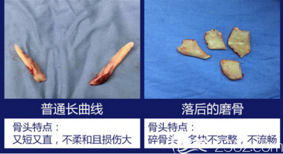 切除的下颌角样子