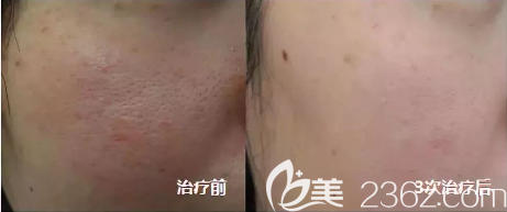 贵阳美莱美肤案例 贵阳美莱美肤案例