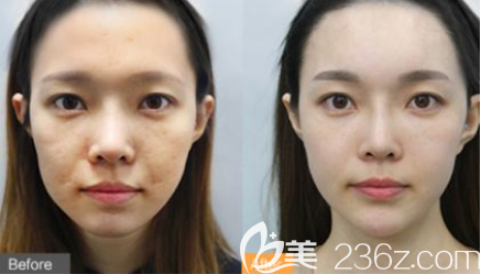 贵阳美莱美肤效果怎么样 贵阳美莱美肤效果怎么样