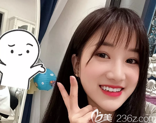 去佛山曙光金子做完线雕术后三天 去佛山曙光金子做完线雕术后三天