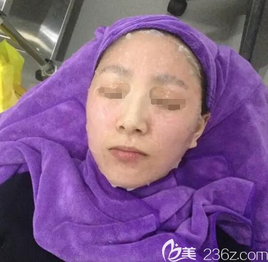 刚做完术后需要敷医用面膜缓解皮肤压力 刚做完术后需要敷医用面膜缓解皮肤压力