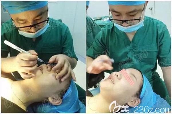 符主任做鼻综合术前设计 符主任做鼻综合术前设计