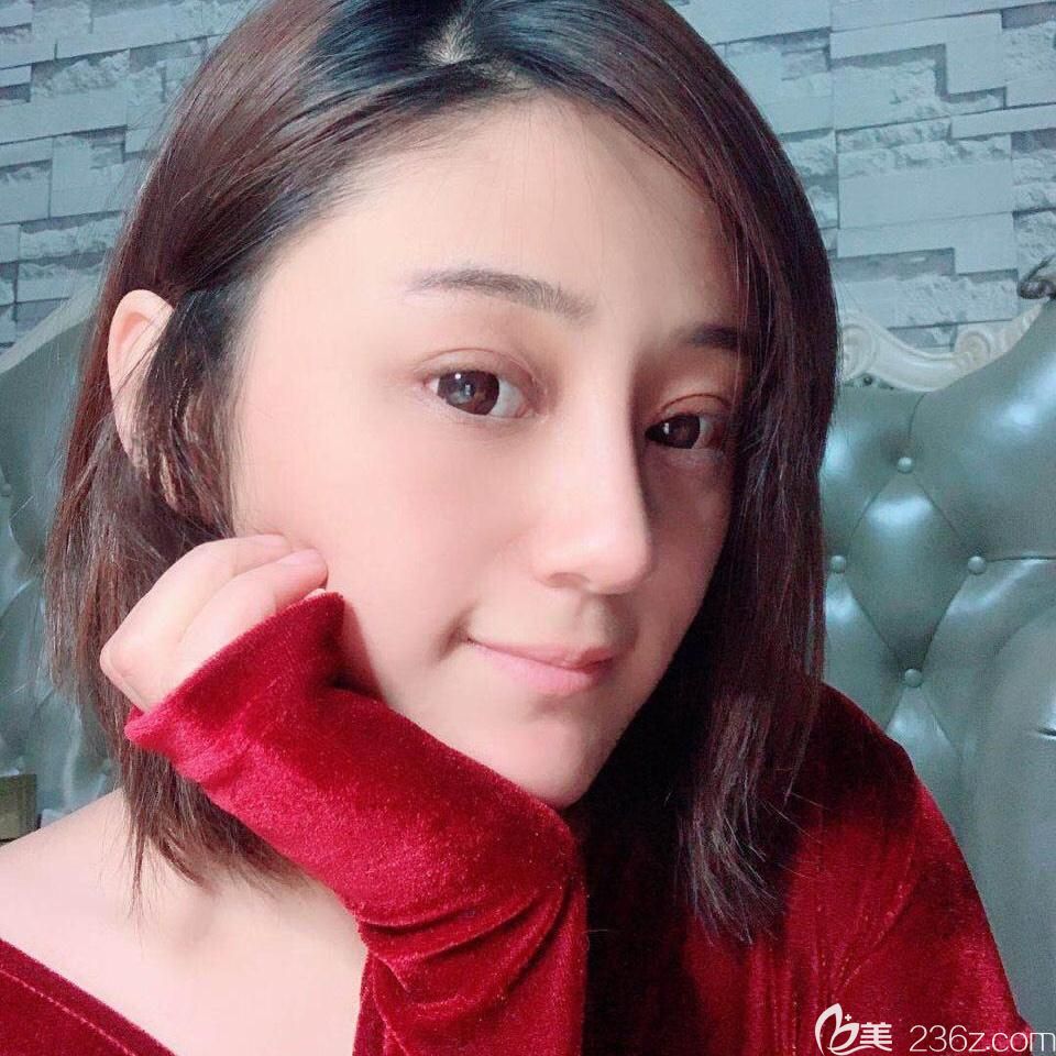 胡准眼鼻综合时候第10天恢复情况 胡准眼鼻综合时候第10天恢复情况