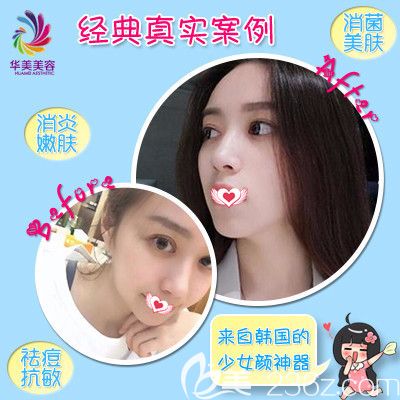 邯郸华美微针美塑案例 邯郸华美微针美塑案例