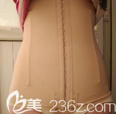 我在南宁韩星整形做腰腹部360度吸脂15天效果 我在南宁韩星整形做腰腹部360度吸脂15天效果