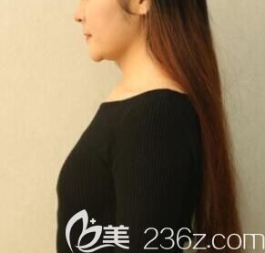 我在南宁东方整形医院做吸脂和丰胸前的照片 我在南宁东方整形医院做吸脂和丰胸前的照片