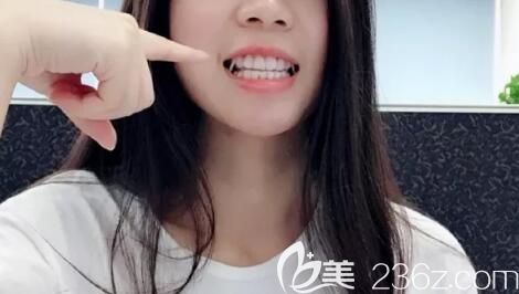 拜博口腔戴隐形牙套打骨钉，挂橡皮筋图