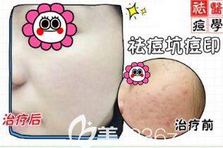 <!--<i data=20240703-sp></li>
                        </a>
                       </ul>
                    </div>
                                        <p>  好的皮肤能够女人看起来更加年轻,更加漂亮,但是因为现在都市压力大,很多成年女性脸上都开始长出痘痘,面对恼人的痘痘怎么办呢?难道要穿梭医院,喝药才能调理吗?今天小编就</p>
                        <div class=