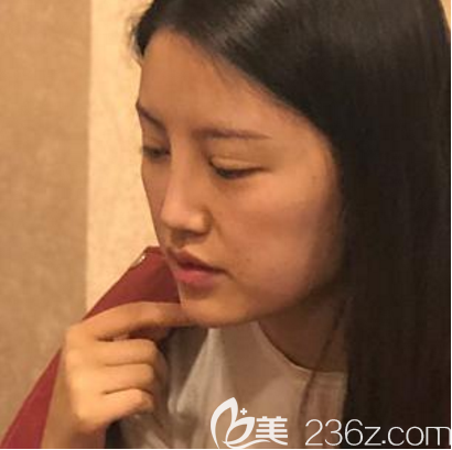 在广州天姿做<span style= 在广州天姿做<span style=