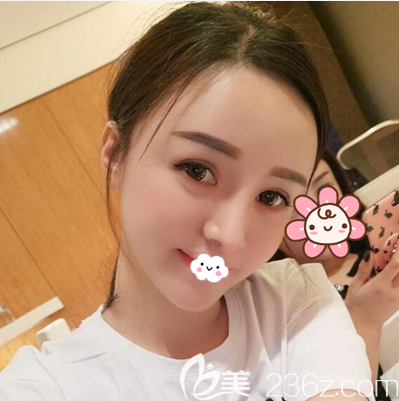 成都西区医院脂肪填充术后一周