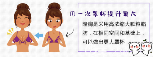 自体脂肪填充示意图