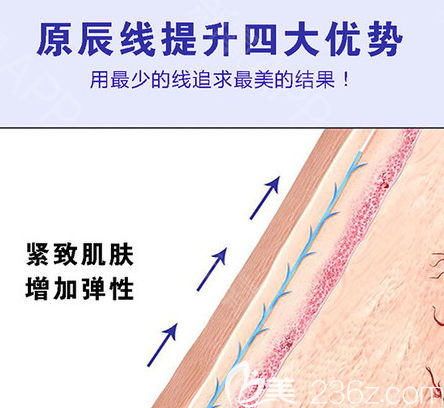 韩国原辰面部提升优势