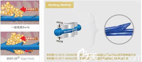 韩国原辰面部埋线提升特点