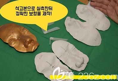韩国YEJUNG HOLIC整形外科隆鼻特色 韩国YEJUNG HOLIC整形外科隆鼻特色