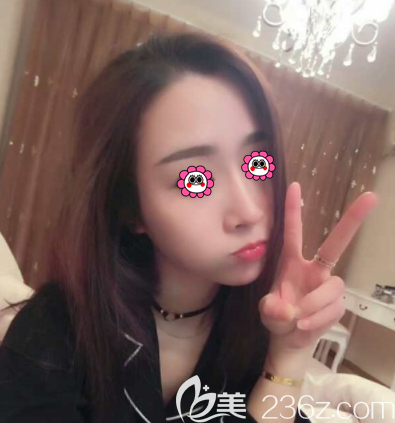 北京艺美范宪红医生鼻部异物取出术案例