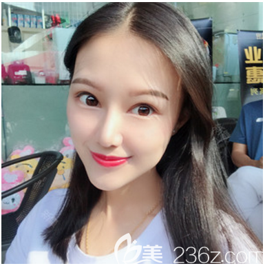 深圳米兰柏羽朱武根做隆鼻子手术怎么样 深圳米兰柏羽朱武根做隆鼻子手术怎么样