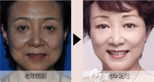 遵义利美康祛斑怎么样 遵义利美康祛斑怎么样